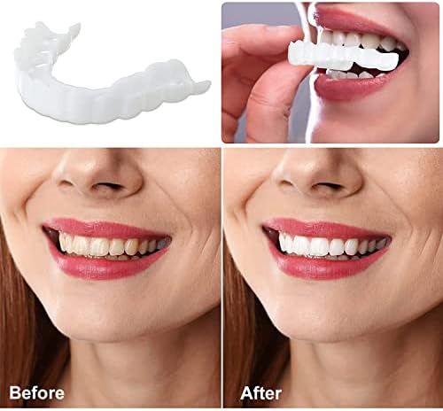 Лажни заби на заби, предвремени насмевка за заби на горните и долните загради за жени и мажи ја подобруваат насмевката