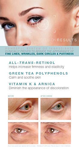Под крем за поправка на очите - Ол -Транс -Ретинол под окото за оживување анти -старечки крем за очи за темни кругови и подпухналост,