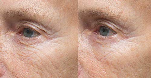 Д-р Денис Скинсинс Хидрошфилд серум за очи Интензивна хидратација на кожата околу очите богати со керамиди, био-идентични липиди, ретинол,