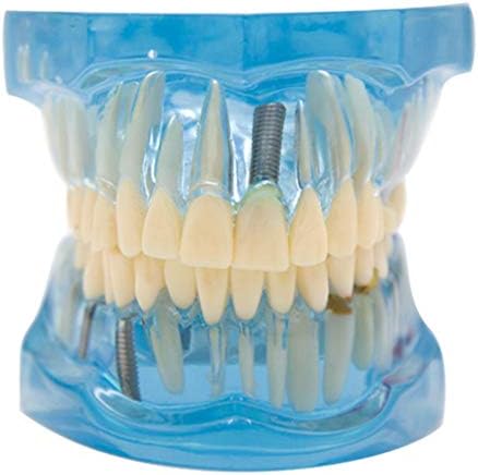 Модел на заби за образование на лемита - модел на заби за заби за заби