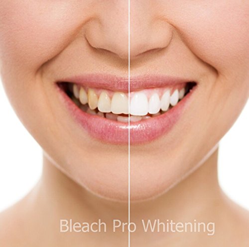 Гел за белење на заби 44% шприцови карбамид пероксид 20 гел за белење на заби 3мл диспензери