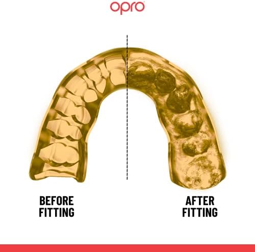 Opro Instant Custom-Fit Count Ports, Стоматолошка уста што има револуционерно фитинг кафез за крајна удобност, заштита и вклопување,