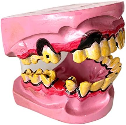 Лемита човечки пушачи Патолошки за забна орален модел - Образование Стоматолошки модел - демонстрација на стоматолошка болест Студија за настава