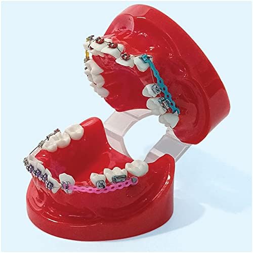KH66ZKY Typodonts Orthodontics Модел на демонстрација - Модел на корекција на ортодонтска малкоклузија - за деца за возрасни за стоматолози