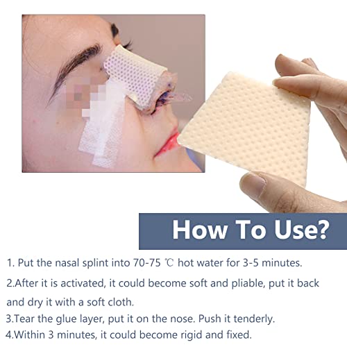 Термопластични назални сплит - Заштитник на надворешна поддршка на носот за фрактура на заградата на носот, операција на септопластика