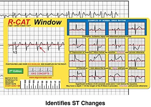 2-то издание R-CAT EKG прозорец